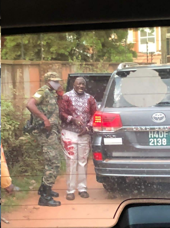 Sgt Khalid Koboyoit and Gen. Katumba Wamala after surviving assasination